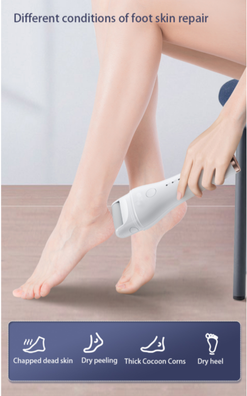 Rock Electric Foot Callus Remover （3 Roller Heads）